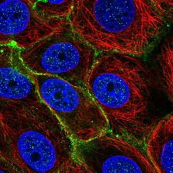SLC5A6 Polyclonal Antibody, Invitrogen 100 &mu;L; Unconjugated:Antibodies,