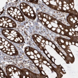 Invitrogen CLUAP1 Polyclonal Antibody 100 &mu;L; Unconjugated:Antibodies,