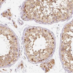 Invitrogen PGAM5 Polyclonal Antibody 100 &mu;L; Unconjugated:Anticuerpos