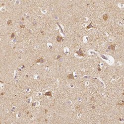 Invitrogen PGAM5 Polyclonal Antibody 100 &mu;L; Unconjugated:Anticuerpos