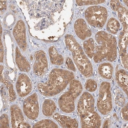 Invitrogen GRINA Polyclonal Antibody 100 &mu;L; Unconjugated:Antibodies,