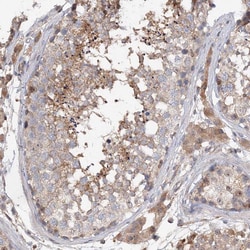 Invitrogen GRINA Polyclonal Antibody 100 &mu;L; Unconjugated:Antibodies,