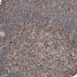 Invitrogen GRSF1 Polyclonal Antibody 100 &mu;L | Buy Online | Invitrogen&trade; | Fisher Scientific