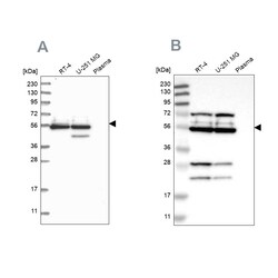 Invitrogen GRSF1 Polyclonal Antibody 100 &mu;L | Buy Online | Invitrogen&trade; | Fisher Scientific