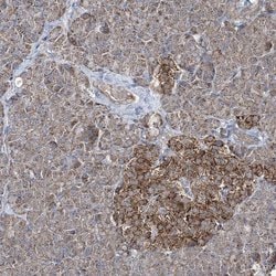 Invitrogen GRSF1 Polyclonal Antibody 100 &mu;L | Buy Online | Invitrogen&trade; | Fisher Scientific
