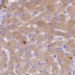 Invitrogen QARS Polyclonal Antibody 100 &mu;L; Unconjugated:Anticorps,