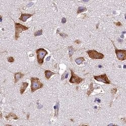 Invitrogen QARS Polyclonal Antibody 100 &mu;L; Unconjugated:Anticorps,