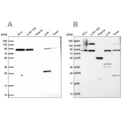 Invitrogen QARS Polyclonal Antibody 100 &mu;L; Unconjugated:Anticorps,