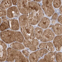 Invitrogen RNF7 Polyclonal Antibody 100 &mu;L; Unconjugated:Antibodies,