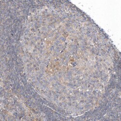 Invitrogen RNF7 Polyclonal Antibody 100 &mu;L; Unconjugated:Antibodies,