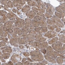 Invitrogen RNF7 Polyclonal Antibody 100 &mu;L; Unconjugated:Antibodies,