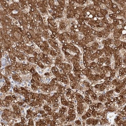 Invitrogen NIT2 Polyclonal Antibody 100 &mu;L; Unconjugated:Antibodies,