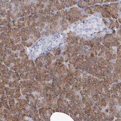 Invitrogen MAN2B2 Polyclonal Antibody 100 &mu;L; Unconjugated:Antibodies,