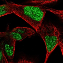 Invitrogen CGGBP1 Polyclonal Antibody 100 &mu;L; Unconjugated:Antibodies,