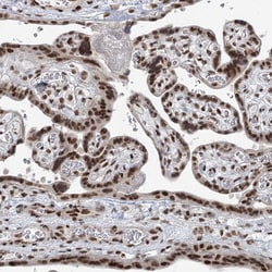 Invitrogen CGGBP1 Polyclonal Antibody 100 &mu;L; Unconjugated:Antibodies,