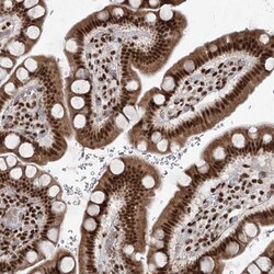 Invitrogen CGGBP1 Polyclonal Antibody 100 &mu;L; Unconjugated:Antibodies,