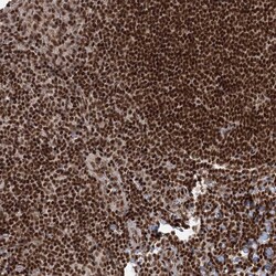 Invitrogen CGGBP1 Polyclonal Antibody 100 &mu;L; Unconjugated:Antibodies,