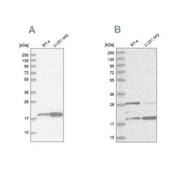 Invitrogen CGGBP1 Polyclonal Antibody 100 &mu;L; Unconjugated:Antibodies,