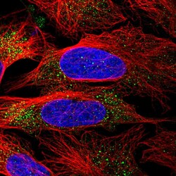 Invitrogen MMAA Polyclonal Antibody 100 &mu;L; Unconjugated:Antibodies,