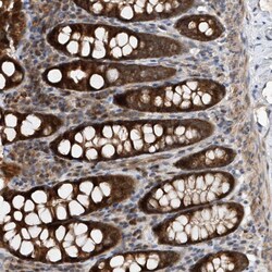 Invitrogen MMAA Polyclonal Antibody 100 &mu;L; Unconjugated:Antibodies,