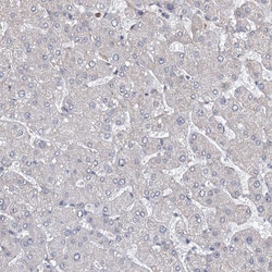 Invitrogen NCAPD2 Polyclonal Antibody 100 &mu;L | Buy Online | Invitrogen&trade; | Fisher Scientific