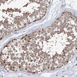 Invitrogen NCAPD2 Polyclonal Antibody 100 &mu;L | Buy Online | Invitrogen&trade; | Fisher Scientific