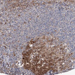 Invitrogen NCAPD2 Polyclonal Antibody 100 &mu;L | Buy Online | Invitrogen&trade; | Fisher Scientific