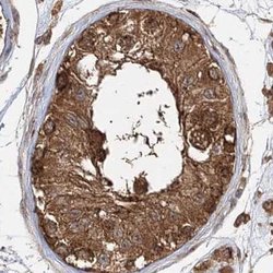 Invitrogen WDR37 Polyclonal Antibody 100 &mu;L; Unconjugated:Antibodies,