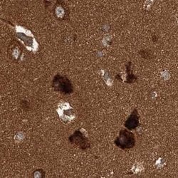 Invitrogen WDR37 Polyclonal Antibody 100 &mu;L; Unconjugated:Antibodies,