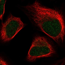 Invitrogen SKIV2L2 Polyclonal Antibody 100 &mu;L; Unconjugated:Antibodies,