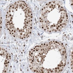 Invitrogen SKIV2L2 Polyclonal Antibody 100 &mu;L; Unconjugated:Antibodies,