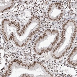 Invitrogen SKIV2L2 Polyclonal Antibody 100 &mu;L; Unconjugated:Antibodies,