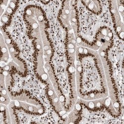 Invitrogen SKIV2L2 Polyclonal Antibody 100 &mu;L; Unconjugated:Antibodies,