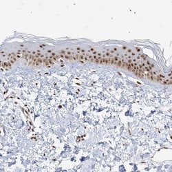 Invitrogen SKIV2L2 Polyclonal Antibody 100 &mu;L; Unconjugated:Antibodies,