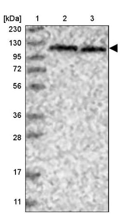 Invitrogen SKIV2L2 Polyclonal Antibody 100 &mu;L | Buy Online | Invitrogen&trade; | Fisher Scientific