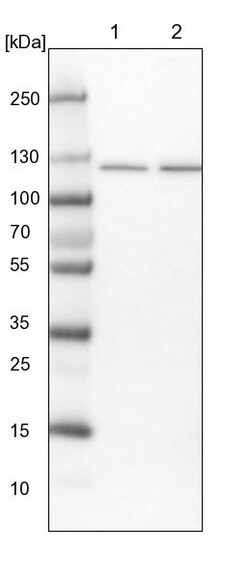 Invitrogen SKIV2L2 Polyclonal Antibody 100 &mu;L | Buy Online | Invitrogen&trade; | Fisher Scientific