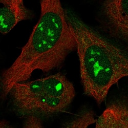 Invitrogen MYL5 Polyclonal Antibody 100 &mu;L; Unconjugated:Antibodies,