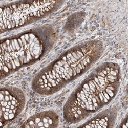 Invitrogen MYL5 Polyclonal Antibody 100 &mu;L; Unconjugated:Antibodies,