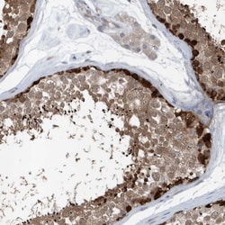 Invitrogen MCC Polyclonal Antibody 100 &mu;L; Unconjugated:Antibodies,