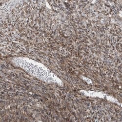 Invitrogen MCC Polyclonal Antibody 100 &mu;L; Unconjugated:Antibodies,