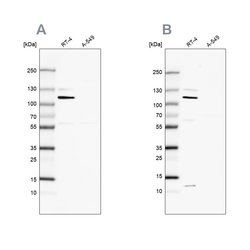 Invitrogen MCC Polyclonal Antibody 100 &mu;L; Unconjugated:Antibodies,