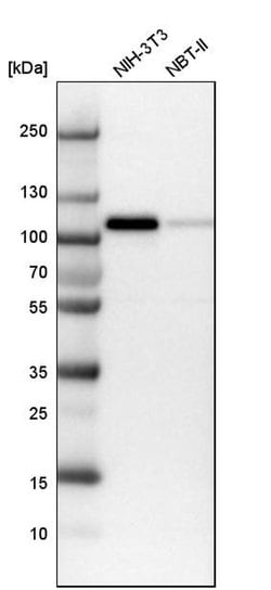 Invitrogen MCC Polyclonal Antibody 100 &mu;L; Unconjugated:Antibodies,