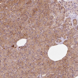 Invitrogen IQGAP2 Polyclonal Antibody 100 &mu;L; Unconjugated:Antibodies,