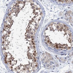 SHE Polyclonal Antibody, Invitrogen™