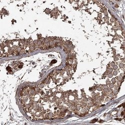 Invitrogen THAP9 Polyclonal Antibody 100 &mu;L; Unconjugated:Antibodies,