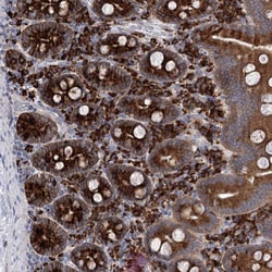 Invitrogen METTL24 Polyclonal Antibody 100 &mu;L; Unconjugated:Antibodies,