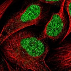 NSMCE4A Polyclonal Antibody, Invitrogen 100 &mu;L; Unconjugated:Antibodies,