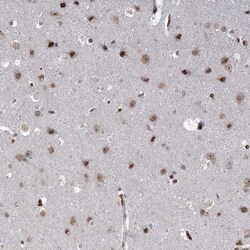 Invitrogen NSMCE4A Polyclonal Antibody 100 &mu;L; Unconjugated:Antibodies,