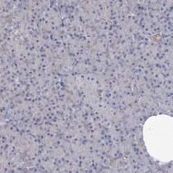 Invitrogen NSMCE4A Polyclonal Antibody 100 &mu;L; Unconjugated:Antibodies,