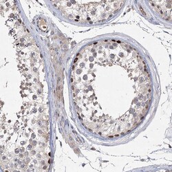 Invitrogen NSMCE4A Polyclonal Antibody 100 &mu;L; Unconjugated:Antibodies,